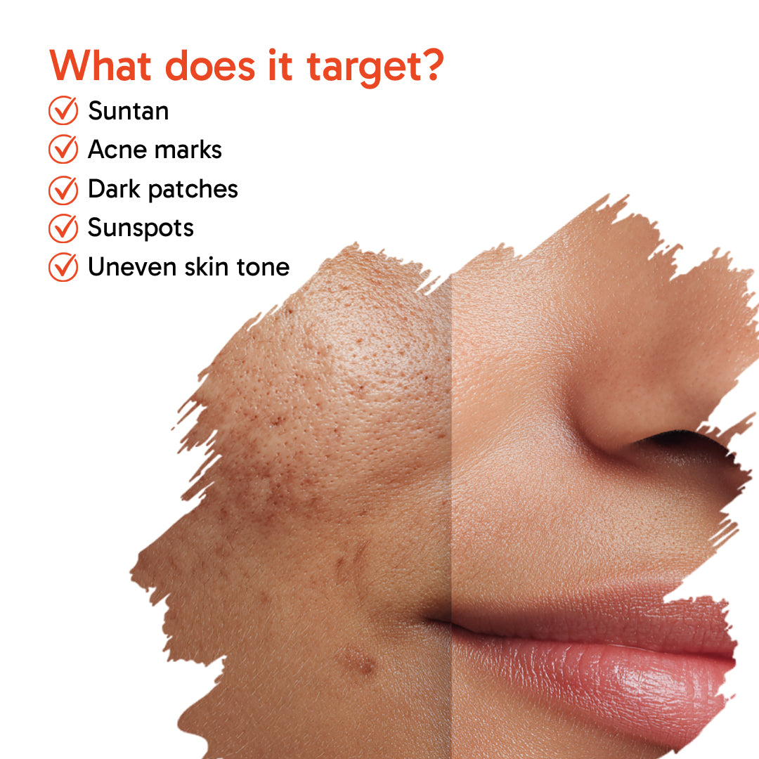 7% Advanced De Tan SUN RESET Glow Foaming Body Wash Gel, 2% Glycolic, 2% Kojic, 3% Niacinamide, Alpha Arbutin, Fights Sun Damage & Brightens Skin - Keya Seth Aromatherapy