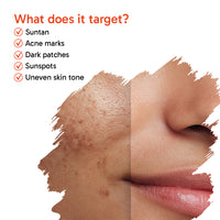 5% Advanced De Tan SUN REST Glow Foaming Face Wash Gel 1% Glycolic, 2% Kojic, 2% Niacinamide, Alpha Arbutin, Fights Sun Damage & Brightens Skin - Keya Seth Aromatherapy