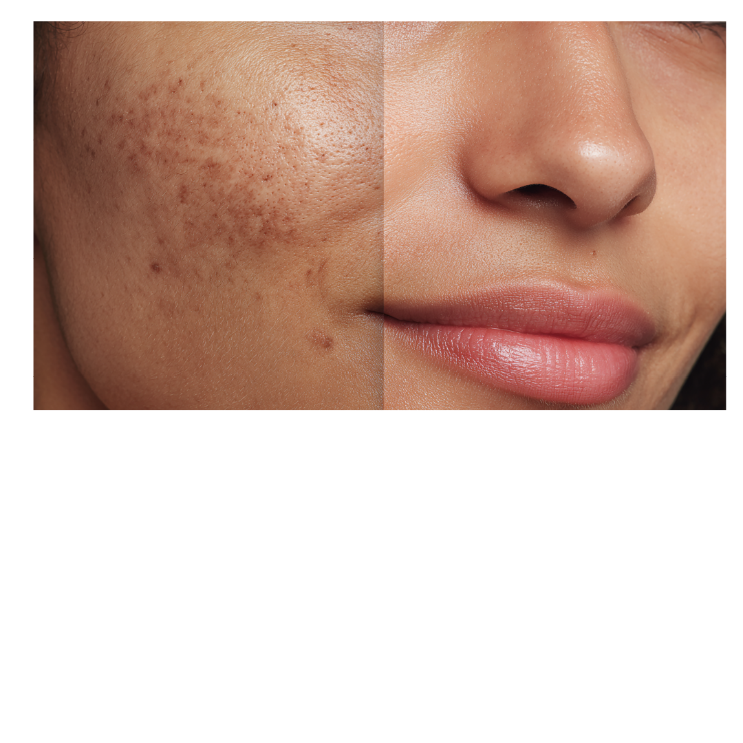 Gluta Glow Code Brightening Serum - Glutathione, 0.5% Alpha Arbutin, 5% Niacinamide, Reduce Dark Spots, Hydrates & Strengthens Skin Barrier - Keya Seth Aromatherapy
