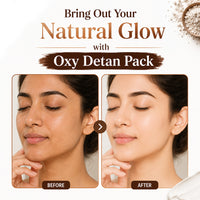 Oxy De Tan Removal for Glowing & Lighting oil Control, Anti Acne & Pimples Blemishes Pigmentation De Tan pack for Face & Body – No Ammonia & Bleach - Keya Seth Aromatherapy